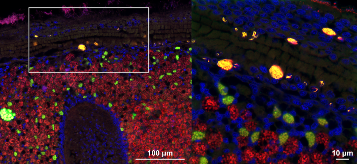 Microscopy image (fluorescence in situ hybridization (FISH) confocal microscopy) of tissues from a deep-sea mussel showing the intranuclear parasite Ca. Endonucleobacter in yellow, and the beneficial symbiotic bacteria in green and red. Cell nuclei are stained blue. The right panel is a zoom-in of the white square in the left panel. (© Miguel Angel Gonzalez-Porras/Max Planck Institute for Marine Microbiology)