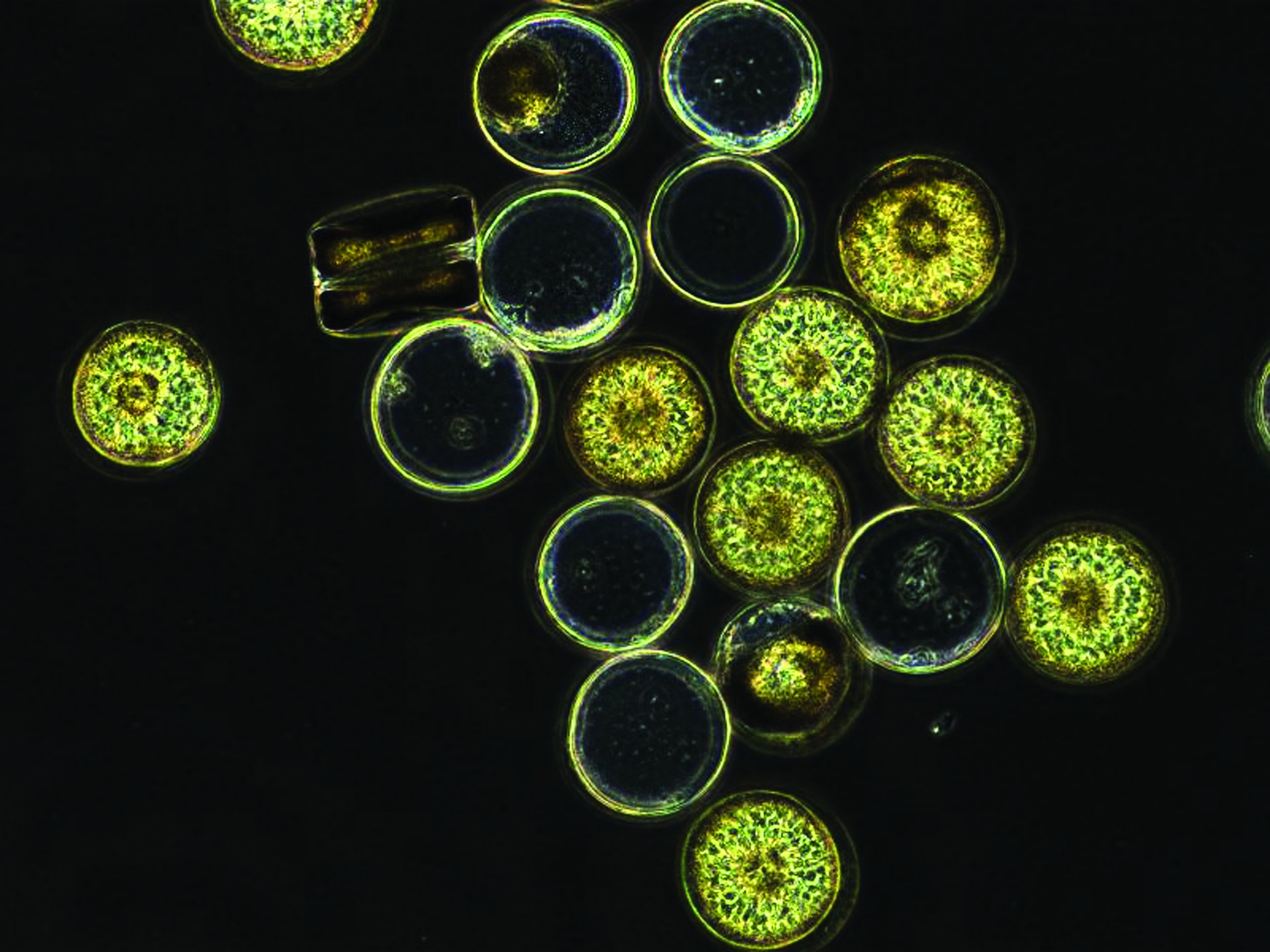 Algen (Coscinodiscus) unter dem Mikroskop
