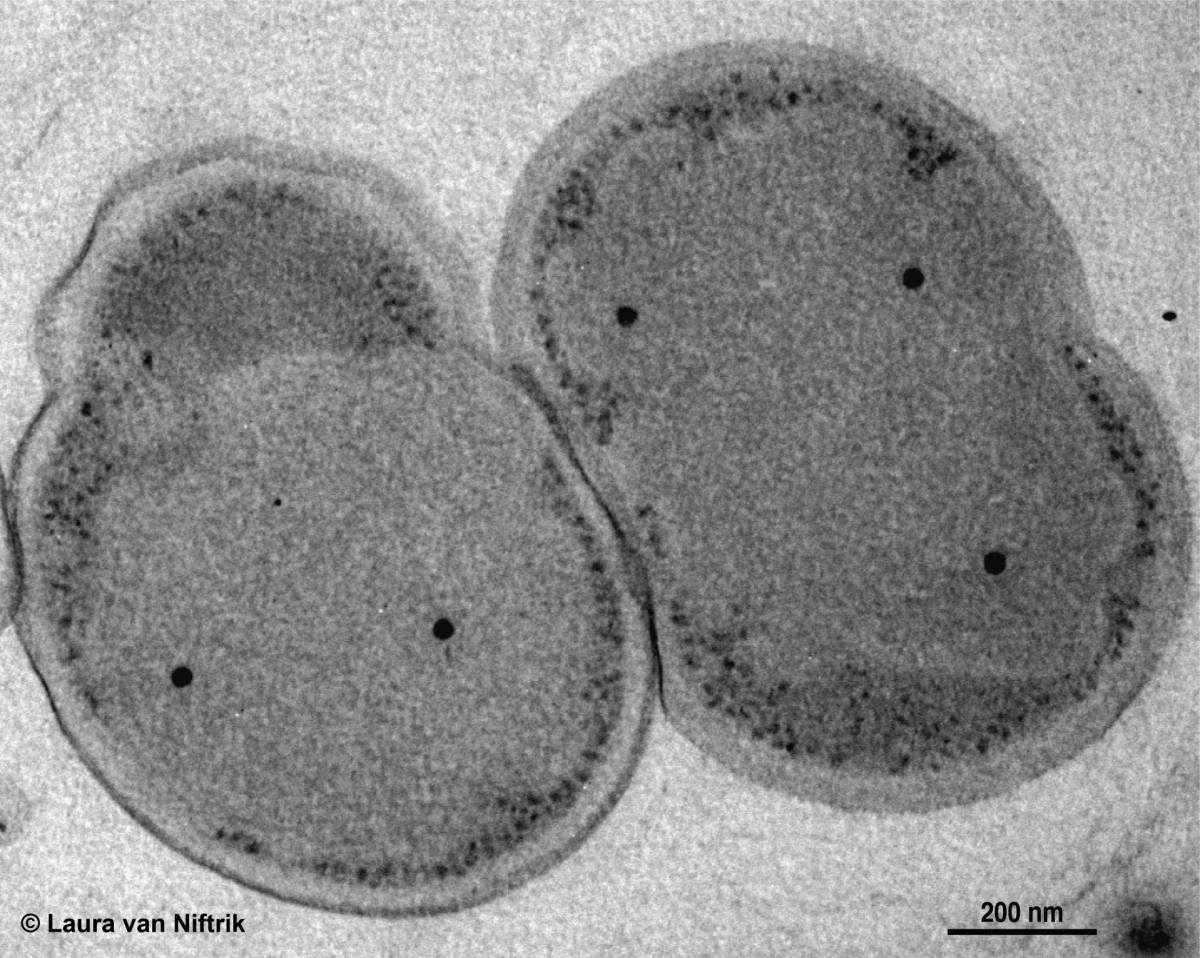 Kuenenia stuttgartiensis, hier unter einem Transmissionselektronenmikroskop zu sehen, ist ein sogenannter Anammox- Modell-Mikroorganismus, der in Form einzelner Zellen wächst. Die Art kommt in Süßwasser, auch in Kläranlagen, vor. © Laura van Niftrik