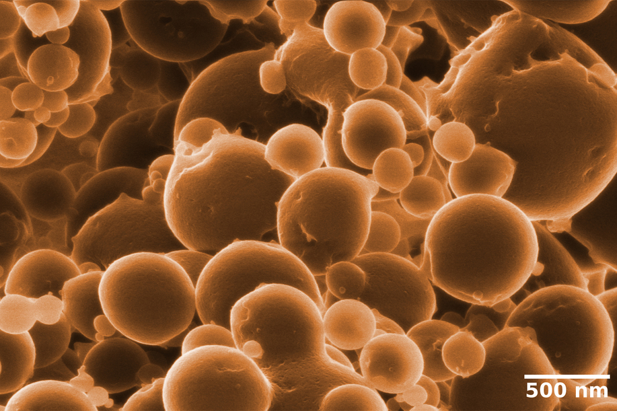 Formation of small vesicles indicate that Candidatus Argoarchaeum ethanivorans divide by budding. The researchers detected these structures with a high-resolution Helium Ion Microscope. The Archaeal cells are extremely small - on average, they are 100-fold thinner than a human hair. © Matthias Schmidt / UFZ.