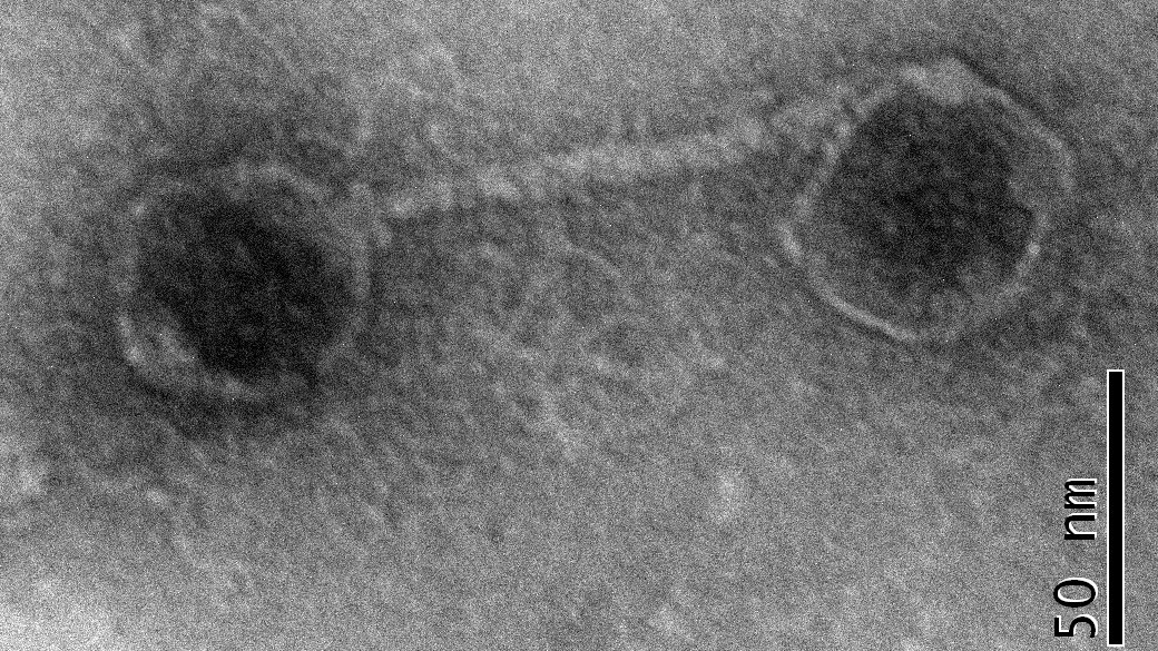 Electron microscopy image of a virus particle attached to a membrane vesicle. (Image: Susanne Erdmann)  