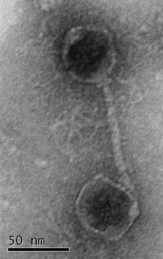 Elektronenmikroskopisches Bild eines Viruspartikels, das an ein Membranvesikel gebunden ist. (© Susanne Erdmann)  
