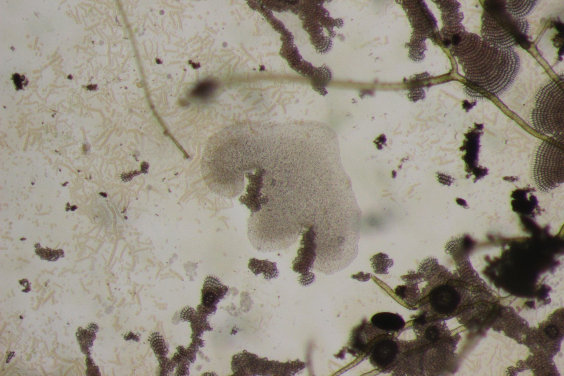 Trichoplax umgeben von Bakterien und Algen. (© Michael Hadfield / Universität Hawaii)