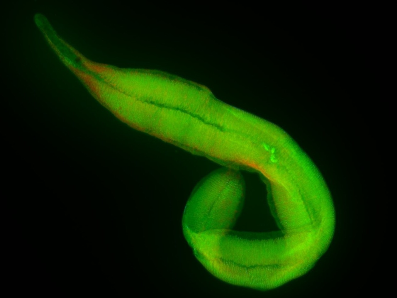 Die gleiche Art von Kentrophoros, gefärbt mit einem Fluoreszenzfarbstoff, der die DNA grün färbt. Die drei hellen Punkte in der Mitte sind die drei Zellkerne des eukaryontischen Wirts. Der grüne „Schleier“ überall sonst sind die dicht gepackten bakteriellen Symbiontenzellen, zu klein, um in diesem Bild einzeln unterscheidbar zu sein. (Quelle: Brandon Seah / Max-Planck-Institut für Marine Mikrobiologie)