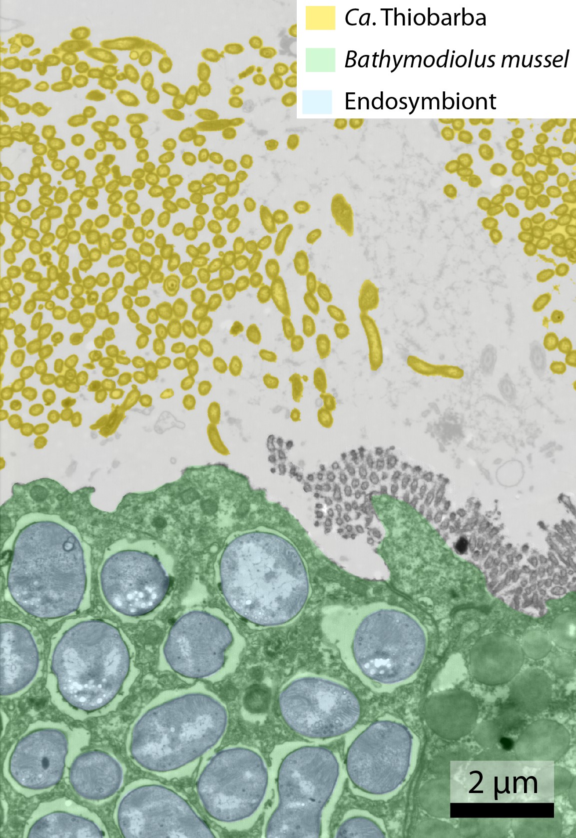 Eingefärbtes Bild aus dem Transmissionselektronenmikroskop; Bathymodiolus-Gewebe in Grün; Zellen von Ca. Thiobarba, die außerhalb der Wirtszellen leben, in Gelb. Der typische Endosymbiont der Bathymodiolus– Muscheln ist hellblau eingefärbt. (© Max-Planck-Institut für Marine Mikrobiologie / Nikolaus Leisch)