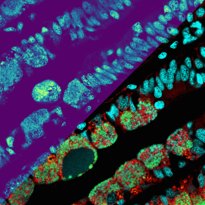 Die Metabolitenverteilungen als Heatmap (oberer linker Teil der Abbildung): je heller die Farbe, desto höher die Konzentration der Metabolite (Mikroskopie-MSI-Nachbildung zur Veranschaulichung). Die untere rechte Seite des Bildes zeigt mikroskopische Details der Mikroben (in Rot und Grün) und der Muschelzellkerne (Cyan). (© Max-Planck-Institut für Marine Mikrobiologie / B. Geier) Die Metabolitenverteilungen als Heatmap (oberer linker Teil der Abbildung): je heller die Farbe, desto höher die Konzentration der Metabolite (Mikroskopie-MSI-Nachbildung zur Veranschaulichung). Die untere rechte Seite des Bildes zeigt mikroskopische Details der Mikroben (in Rot und Grün) und der Muschelzellkerne (Cyan). (© Max-Planck-Institut für Marine Mikrobiologie / B. Geier)