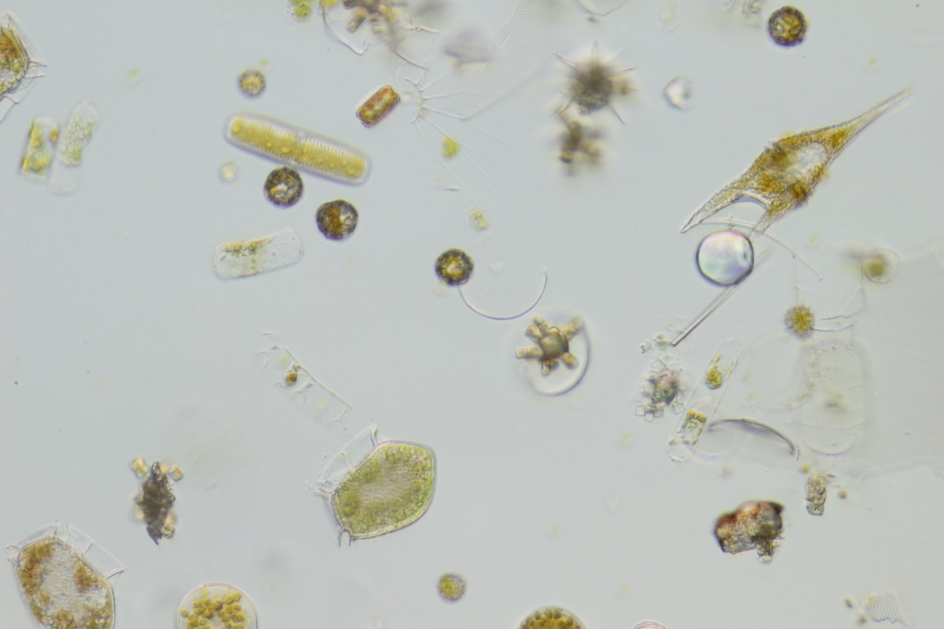 Phytoplankton (or microalgae) in the Canary Islands upwelling area. (© Max Planck Institute for Marine Microbiology)