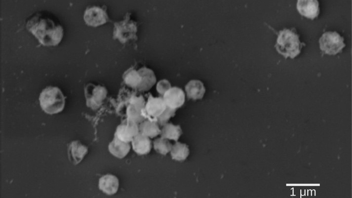 Elektronen-mikroskopische Aufnahme von Lentimonas, das Bakterium an dem für die Studie gearbeitet wurde. Man sieht, dass die Zellen kleine runde Kokken sind und als Aggregat wachsen.