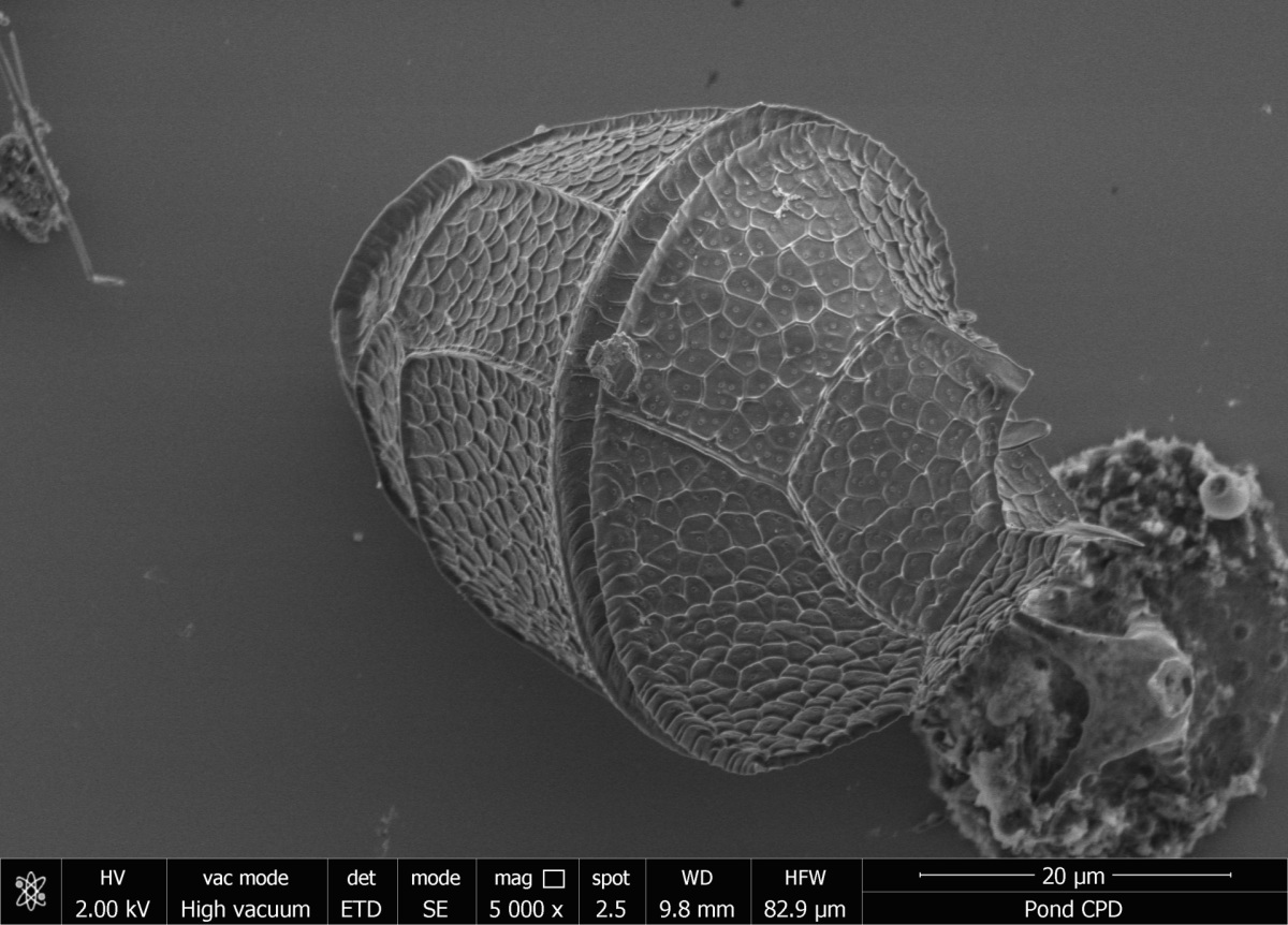 Sekundär-Elektronen-Abbildung eines Dinoflagellaten aus dem Teich an unserem Institut, präpariert mit CPD (©  Max-Planck-Institut für Marine Mikrobiologie, S. Littmann)