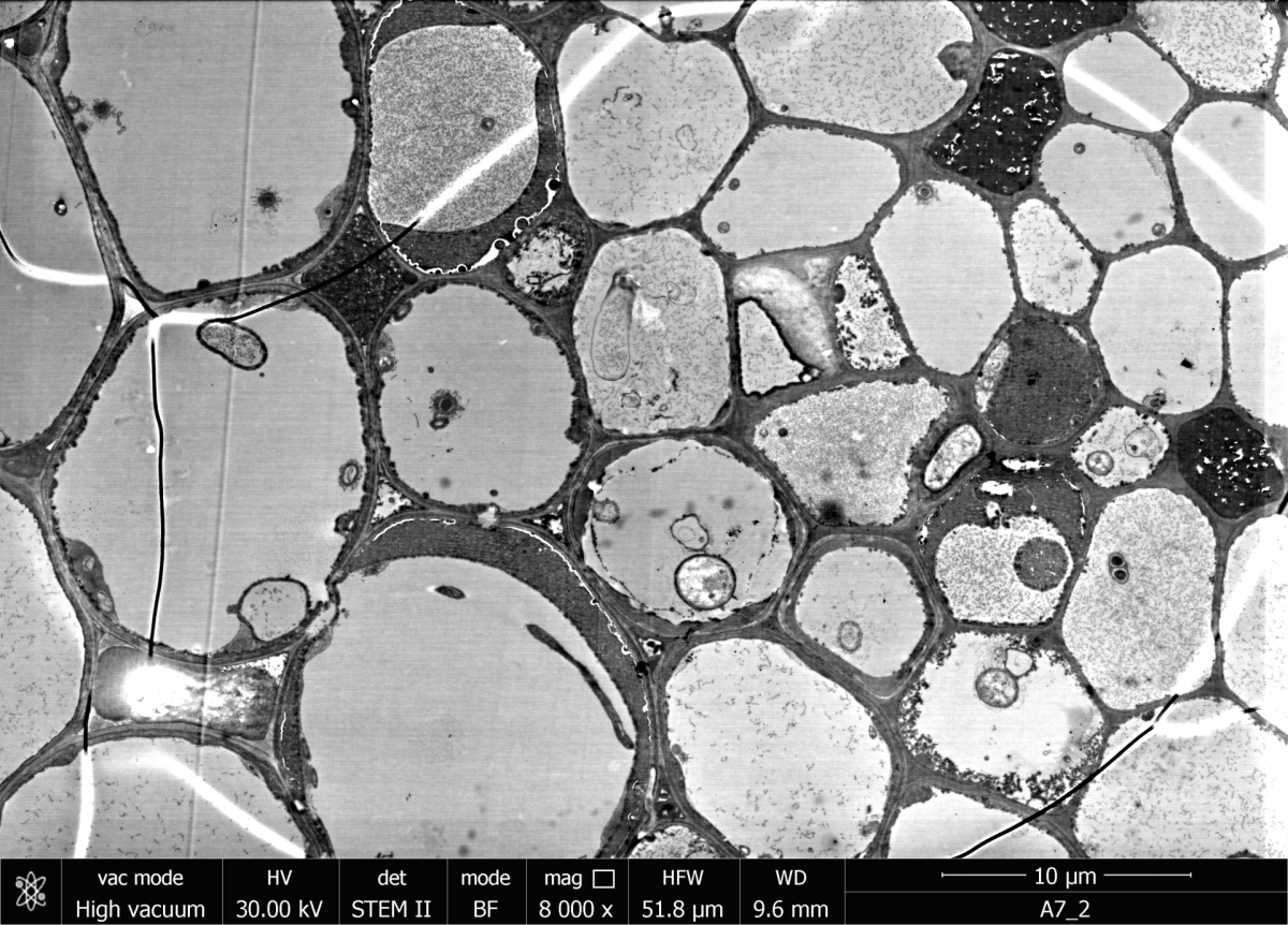 STEM-Abbildung eines Dünnschnitts eines Seegras-Wurzelstück. (© Max-Planck-Institut für Marine Mikrobiologie, S. Littmann)