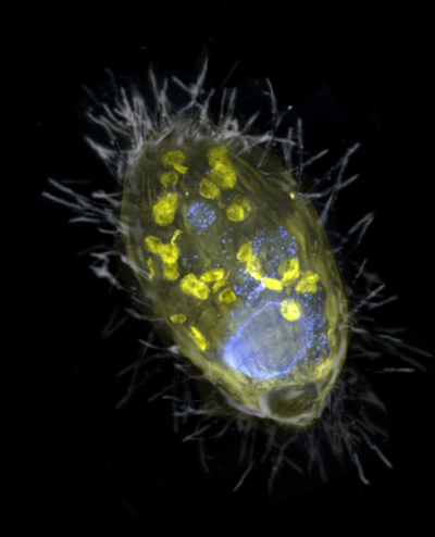 anaerobic ciliate anaerobic ciliate