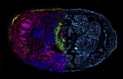Das Bild zeigt den Querschnitt eines ganzen Regenwurms, verwendet wurden Aufnahmen mit folgenden zwei Techniken: Massenspektrometrie-Bildgebung (links) und Fluoreszenzmikroskopie (rechts). Die Farben der Massenspektrometrie-Bilddaten zeigen die Verteilung der unterschiedlichen Stoffwechselprodukte im Gewebe, während die Fluoreszenzmikroskopie die den chemischen Verteilungen zugrunde liegenden Gewebestrukturen zeigt. (© Max-Planck-Institut für Marine Mikrobiologie/B. Geier) Das Bild zeigt den Querschnitt eines ganzen Regenwurms, verwendet wurden Aufnahmen mit folgenden zwei Techniken: Massenspektrometrie-Bildgebung (links) und Fluoreszenzmikroskopie (rechts). Die Farben der Massenspektrometrie-Bilddaten zeigen die Verteilung der unterschiedlichen Stoffwechselprodukte im Gewebe, während die Fluoreszenzmikroskopie die den chemischen Verteilungen zugrunde liegenden Gewebestrukturen zeigt. (© Max-Planck-Institut für Marine Mikrobiologie/B. Geier)