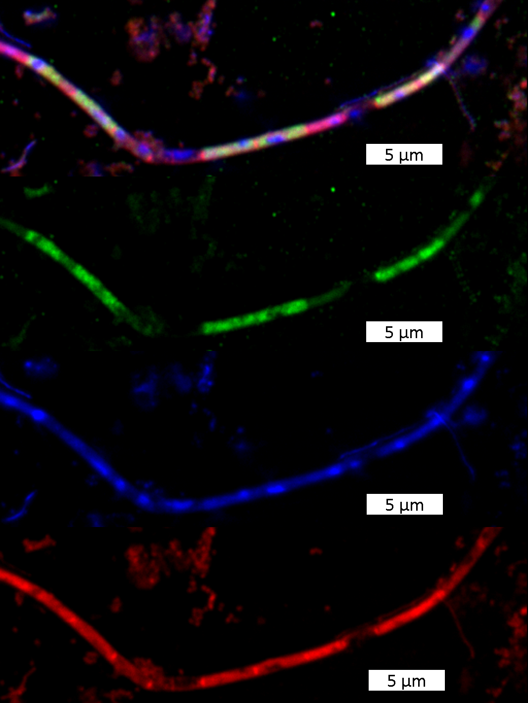 Images of Methanosaeta, a filamentous methanogenic archaeon, from the fluorescence microscope.